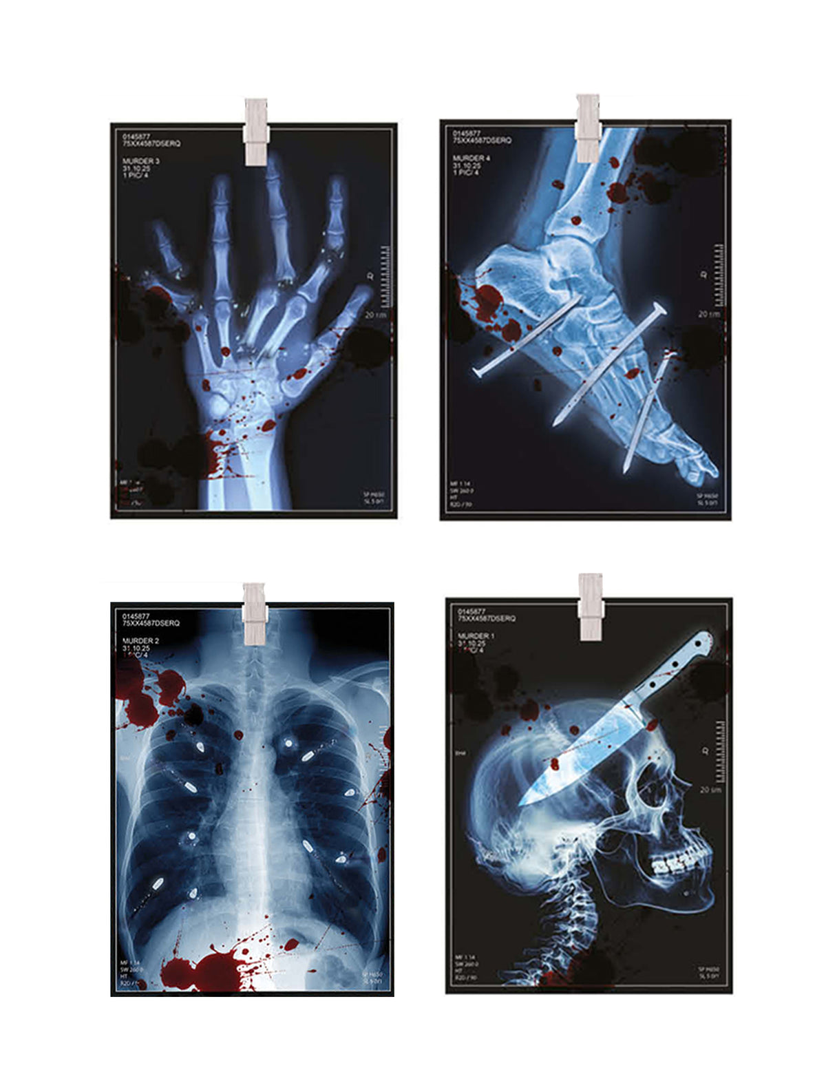 Guirlande radiographies Halloween en papier bleue avec taches de sang